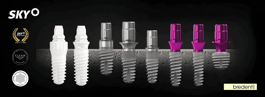 Implant dentar: o soluție modernă pentru înlocuirea dinților lipsă