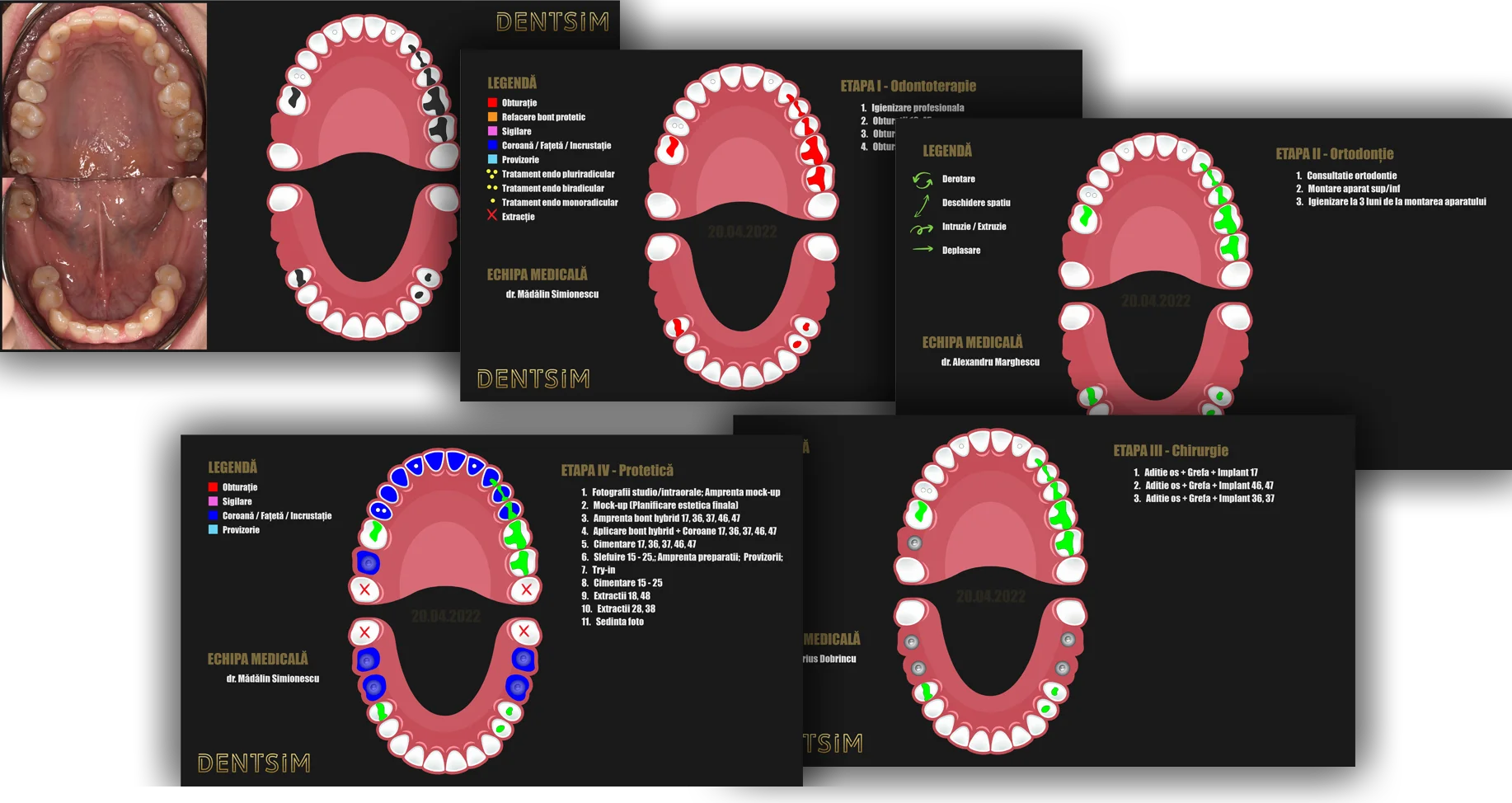 Plan de tratament realizat exclusiv la DentSIM